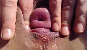 Anal prolapse, slit spread and cervix